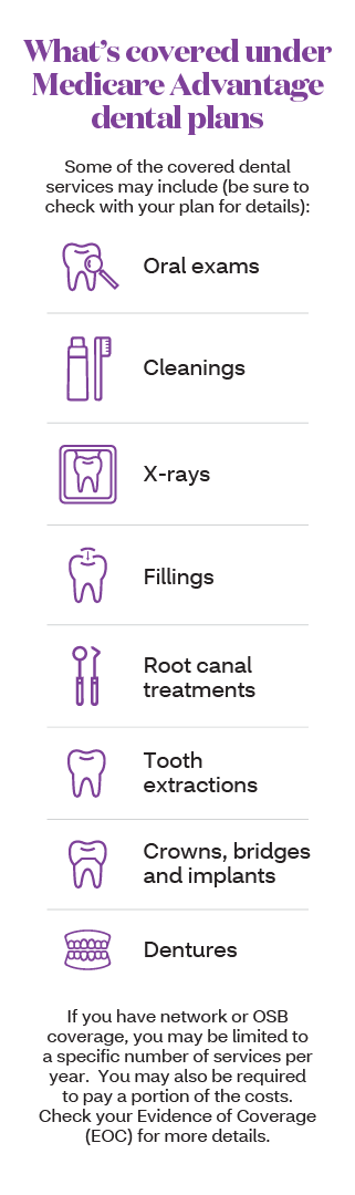 Does Aetna Dental Cover Dentures?